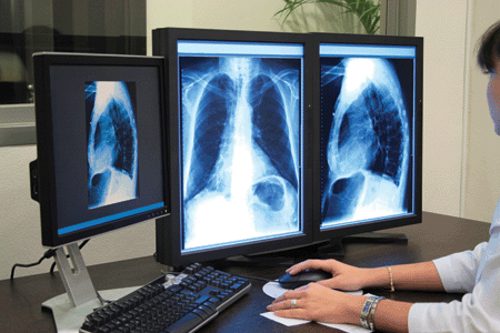 Image: Viewing Xrays
